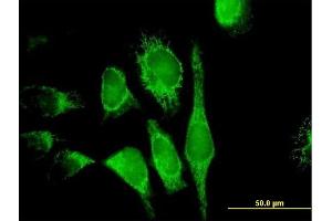 Immunofluorescence of purified MaxPab antibody to PDCD8 on HeLa cell.