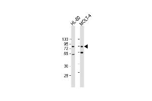 All lanes : Anti-CBFA2T3 Antibody at 1:500-1:2000 dilution Lane 1: HL-60 whole cell lysate Lane 2: MOLT-4 whole cell lysate Lysates/proteins at 20 μg per lane. (CBFA2T3 antibody  (AA 418-653))