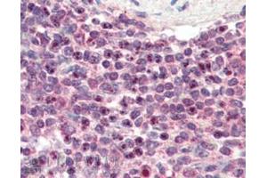 ABIN185293 (3µg/ml) staining of paraffin embedded Human Spleen. (NR1H2 antibody  (N-Term))