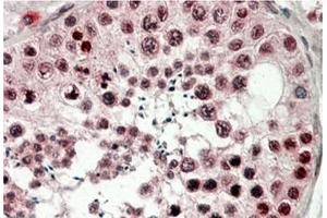 AP21512PU-N CIRBP antibody staining of paraffin embedded Human Testis at 3. (CIRBP antibody  (C-Term))
