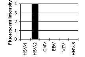 Cross Reactivity Results determined by IFA (HSV2 ICP8 antibody)