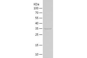 Western Blotting (WB) image for Cytochrome C, Somatic (CYCS) (AA 1-105) protein (His-IF2DI Tag) (ABIN7282325) (Cytochrome C Protein (AA 1-105) (His-IF2DI Tag))