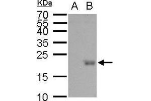 WB Image UBE2B antibody detects UBE2B protein by western blot analysis. (UBE2B antibody)