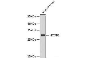 Western blot analysis of extracts of Mouse heart using HOXB1 Polyclonal Antibody at dilution of 1:1000. (HOXB1 antibody)