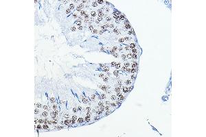 Immunohistochemistry (IHC) image for anti-FOS-Like Antigen 1 (FOSL1) (AA 1-100) antibody (ABIN6140738)
