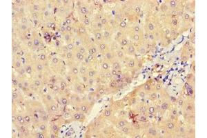 Immunohistochemistry of paraffin-embedded human liver tissue using ABIN7175166 at dilution of 1:100 (UGP2 antibody  (AA 1-497))