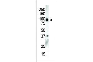 Western blot analysis of anti-PKCnu C-term Pab (ABIN391015 and ABIN2841187) in NCI- cell lysate. (PRKD3 antibody  (C-Term))