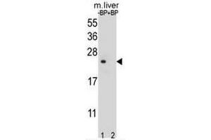 Western blot analysis of T4S4 Antibody (N-term) Pab pre-incubated without(lane 1) and with(lane 2) blocking peptide in liver cell line lysate.