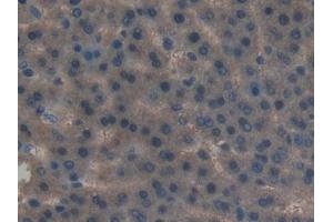 Immunohistochemistry (IHC) image for anti-Leukemia Inhibitory Factor Receptor alpha (LIFR) (AA 382-486) antibody (ABIN7437992)