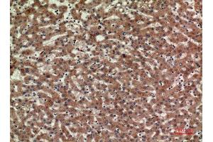 Immunohistochemistry (IHC) analysis of paraffin-embedded Human Liver, antibody was diluted at 1:100. (CD3D antibody  (Internal Region))