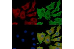 anti-ATPase, H+ Transporting, Lysosomal 16kDa, V0 Subunit C (ATP6V0C) antibody