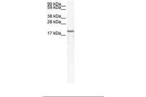 Image no. 1 for anti-Chemokine (C-X-C Motif) Ligand 14 (CXCL14) (C-Term) antibody (ABIN202018)