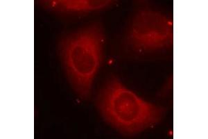 Immunofluorescence staining of methanol-fixed Hela cells using LIMK2(Phospho-Thr505) Antibody. (LIMK2 antibody  (pThr505))