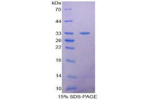 SDS-PAGE (SDS) image for Heme Oxygenase (Decycling) 2 (HMOX2) (AA 41-292) protein (His tag) (ABIN2125166)