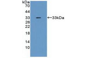 Detection of Recombinant TNFaIP6, Mouse using Polyclonal Antibody to Tumor Necrosis Factor Alpha Induced Protein 6 (TNFaIP6) (TNFAIP6 antibody  (AA 18-275))