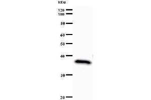 Western Blotting (WB) image for anti-Set1/Ash2 Histone Methyltransferase Complex Subunit ASH2 (ASH2L) antibody (ABIN933109) (ASH2L antibody)