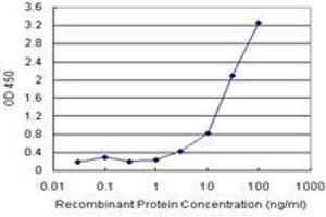 Sandwich ELISA detection sensitivity ranging from 1 ng/mL to 100 ng/mL. (HDAC7 (Human) Matched Antibody Pair)