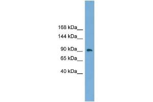 Human Placenta; WB Suggested Anti-ZNF226 Antibody Titration: 0.