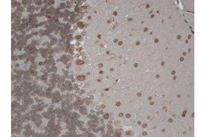 Immunohistochemistry (IHC) image for anti-Transient Receptor Potential Cation Channel, Subfamily M, Member 7 (TRPM7) (C-Term) antibody (ABIN6657588)