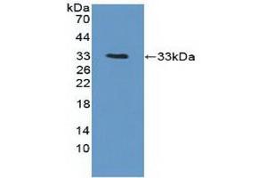 Detection of Recombinant PTK6, Human using Polyclonal Antibody to Protein Tyrosine Kinase 6 (PTK6) (PTK6 antibody  (AA 191-445))