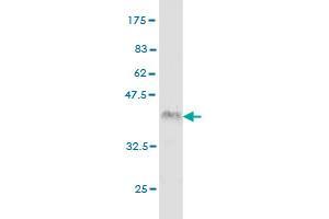 Western Blot detection against Immunogen (36. (IRAK2 antibody  (AA 111-210))
