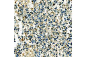 IHC analysis of Hexokinase 1/HK1 using anti-Hexokinase 1/HK1 antibody (ABIN7600259). (Hexokinase 1 antibody  (AA 17-323))