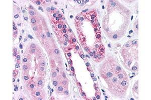Anti-CASR/Calcium Sensing Receptor antibody IHC of human kidney, diabetes. (CASR antibody  (N-Term))