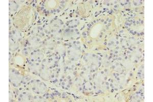 Immunohistochemistry of paraffin-embedded human pancreatic tissue using ABIN7142054 at dilution of 1:100 (PLCD4 antibody  (AA 1-762))