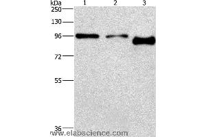 Western blot analysis of A431 and hela cell,mouse brain tissue, using PIP5K1C Polyclonal Antibody at dilution of 1:500 (PIP5K1C antibody)