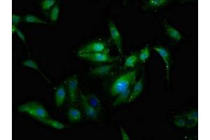 Immunofluorescence staining of Hela cells with ABIN7143574 at 1:133, counter-stained with DAPI. (SSX2IP antibody  (AA 485-614))
