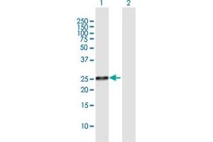 Western Blot analysis of FLJ22662 expression in transfected 293T cell line by FLJ22662 MaxPab polyclonal antibody. (FLJ22662 (AA 1-223) antibody)