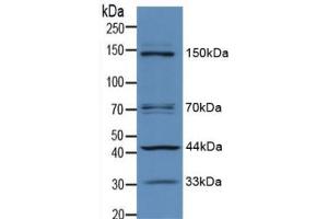 Figure. (IRS1 antibody  (AA 837-1089))