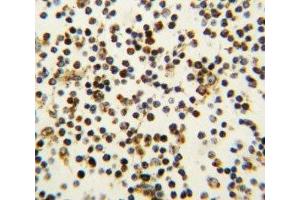 Immunohistochemistry (IHC) image for anti-Nucleophosmin (Nucleolar phosphoprotein B23, Numatrin) (NPM1) (AA 7-33) antibody (ABIN3032075)