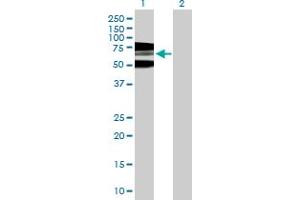 Western Blot analysis of RNF168 expression in transfected 293T cell line by RNF168 MaxPab polyclonal antibody. (RNF168 antibody  (AA 1-571))