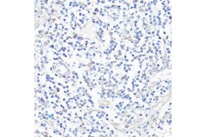 Immunohistochemistry of paraffin-embedded human tonsil using CASP3 antibody. (Caspase 3 antibody  (AA 55-160))