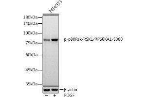 Western blot analysis of extracts of NIH/3T3 cells, using Phospho-p90Rsk/RSK1/RPS6K-S380 antibody (ABIN7270036) at 1:1000 dilution. (RPS6KA1 antibody  (pSer380))