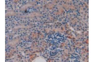 Figure. (CYR61 antibody  (AA 176-379))