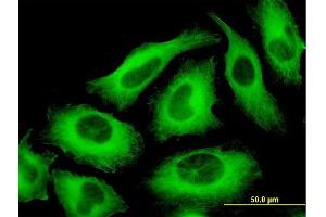 Immunofluorescence of monoclonal antibody to TUBA6 on HeLa cell. (TUBA1C antibody  (AA 1-449))