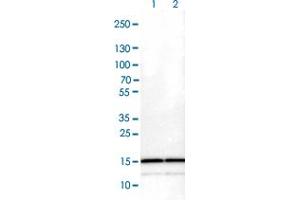 Western blot analysis of Lane 1: NIH-3T3 cell lysate (Mouse embryonic fibroblast cells) Lane 2: NBT-II cell lysate (Rat Wistar bladder tumour cells) with RPL23 polyclonal antibody  at 1:250-1:500 dilution. (RPL23 antibody)