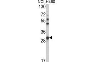 Western Blotting (WB) image for anti-Glutathione S-Transferase omega 1 (GSTO1) antibody (ABIN3001725) (GSTO1 antibody)