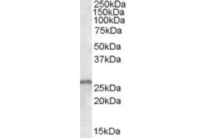 Image no. 1 for anti-SMN1 / SMN2 (all Isoforms), (Internal Region) antibody (ABIN374850) (SMN1 / SMN2 (all Isoforms), (Internal Region) antibody)