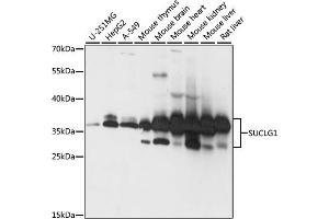 Western blot analysis of extracts of various cell lines, using SUCLG1 antibody (ABIN7270623) at 1:1000 dilution. (SUCLG1 antibody  (AA 41-346))