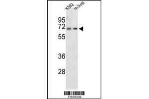 Western blot analysis of CROT Antibody in K562 cell line and mouse liver tissue lysates (35ug/lane)