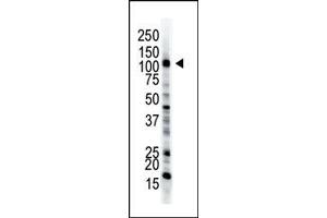 Image no. 1 for anti-Ubiquitin-Like Modifier Activating Enzyme 1 (UBA1) (C-Term) antibody (ABIN357486) (UBA1 antibody  (C-Term))