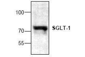 Image no. 1 for anti-Solute Carrier Family 5 (Sodium/glucose Cotransporter), Member 1 (SLC5A1) antibody (ABIN127319) (SLC5A1 antibody)