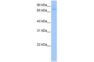 WB Suggested Anti-ZNF440 Antibody Titration:  0. (ZNF440 antibody  (C-Term))