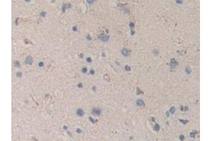 Detection of MAPKAPK2 in Human Cerebrum Tissue using Polyclonal Antibody to MAP Kinase Activated Protein Kinase 2 (MAPKAPK2) (MAPKAP Kinase 2 antibody  (AA 139-367))