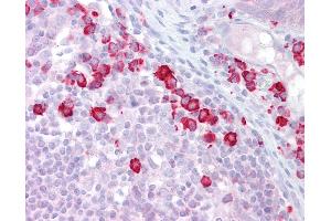 Anti-DAK antibody IHC of human tonsil. (DAK antibody  (N-Term))