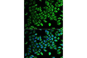 Immunofluorescence analysis of HeLa cells using DDAH2 antibody. (DDAH2 antibody)