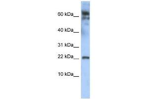 LDOC1 antibody used at 0. (LDOC1 antibody  (N-Term))